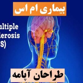 تحقیق ام اس