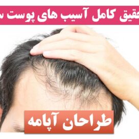 پاورپوینت پوست سر